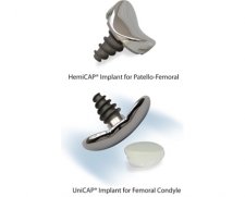 Arthrosurface Knee HemiCAP systems | Which Medical Device